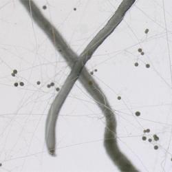 Two grey roots cross over each other to form an X. Around them are very thin fungal hyphae which run all over criss-crossing the image. They have small circular nodules on them